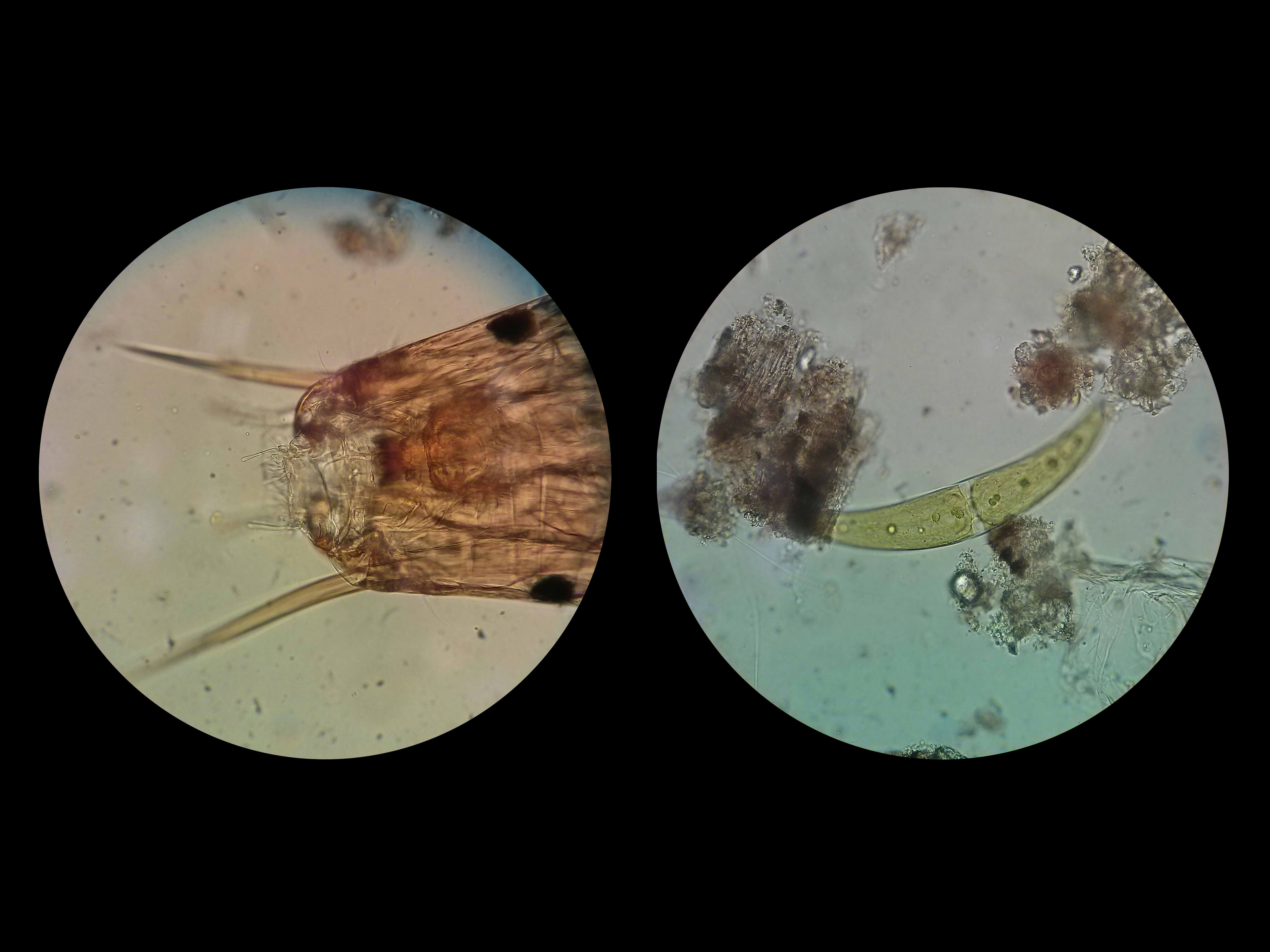 Water organisms (such as algae and dinoflagellate) under the microscopes. [Photo-credit: Ecobus]